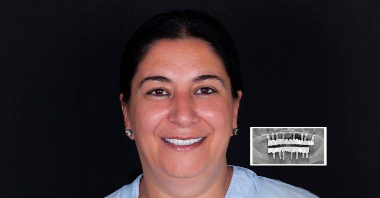 dentaldesignturkey