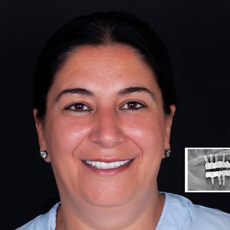 dentaldesignturkey